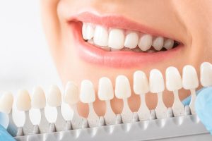How We Scaled Whitening Services in Dallas with One Smart Upgrade